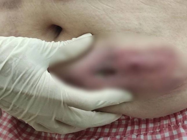 Quý bà tan nát cơ thể vì mê làm đẹp cấp tốc - Ảnh 2. Quý bà tan nát cơ thể vì mê làm đẹp cấp tốc - Ảnh 2.