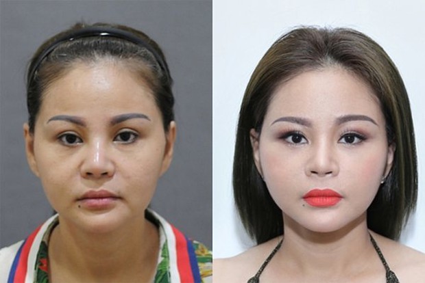 Lê Giang tiết lộ kỷ lục dao kéo: Mũi sửa 10 lần, cằm 2 lần..., khác lạ đến mức con trai không nhận ra? - Ảnh 6. Lê Giang tiết lộ kỷ lục dao kéo: Mũi sửa 10 lần, cằm 2 lần..., khác lạ đến mức con trai không nhận ra? - Ảnh 6.