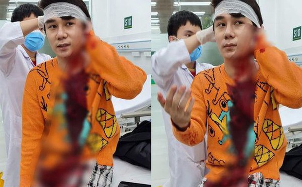Nam diễn viên trong phim Thương ngày nắng về bị chém nhiều nhát vào người - Ảnh 1.