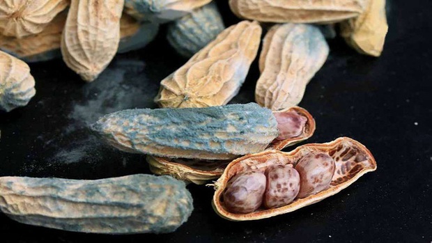 Con trai bị ung thư gan, cha mẹ khóc ngất khi bác sĩ chỉ ra nguyên nhân từ 1 thói quen tiết kiệm thực phẩm, nhà nào cũng từng mắc - Ảnh 3. Con trai bị ung thư gan, cha mẹ khóc ngất khi bác sĩ chỉ ra nguyên nhân từ 1 thói quen tiết kiệm thực phẩm, nhà nào cũng từng mắc - Ảnh 3.
