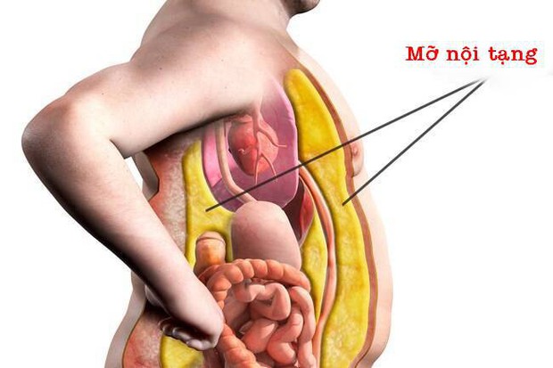 Loại mỡ này bao quanh các cơ quan trong bụng gây bệnh tiểu đường, bệnh tim, gan nhiễm mỡ, làm được 4 việc sẽ không còn lo nữa - Ảnh 1. Loại mỡ này bao quanh các cơ quan trong bụng gây bệnh tiểu đường, bệnh tim, gan nhiễm mỡ, làm được 4 việc sẽ không còn lo nữa - Ảnh 1.