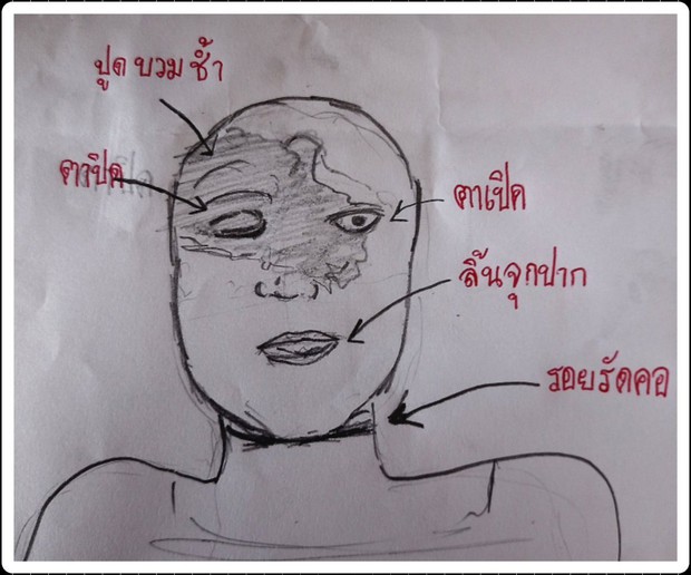 Sốc nặng hình vẽ nghi vấn mô phỏng toàn bộ vết thương trên mặt của nữ diễn viên Chiếc Lá Bay: Có dấu hiệu bị siết cổ? - Ảnh 3.