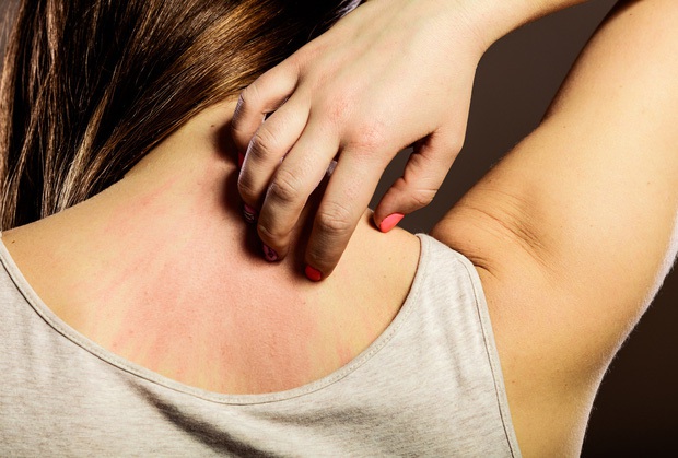 Đừng bỏ qua 4 biểu hiện bất thường trên da vì nó có thể là dấu hiệu sớm của bệnh ung thư - Ảnh 3. Đừng bỏ qua 4 biểu hiện bất thường trên da vì nó có thể là dấu hiệu sớm của bệnh ung thư - Ảnh 3.
