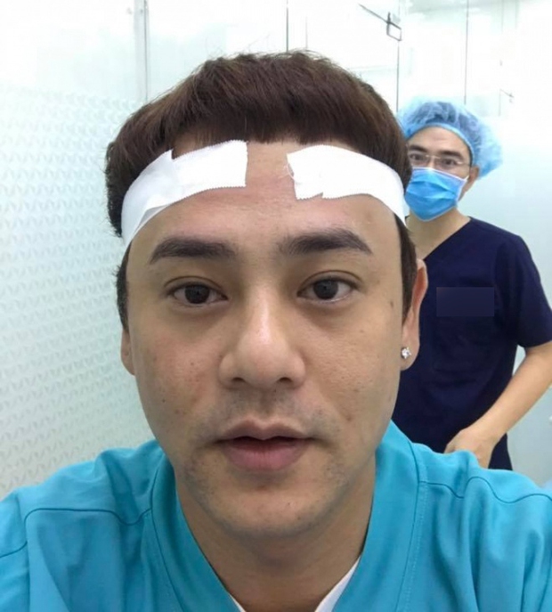 Một sao nam từng bị bóc đội tóc giả ở Sao Nhập Ngũ, phải cấy tóc sau khi lộ hói trên sóng truyền hình - Ảnh 6. Một sao nam từng bị bóc đội tóc giả ở Sao Nhập Ngũ, phải cấy tóc sau khi lộ hói trên sóng truyền hình - Ảnh 6.