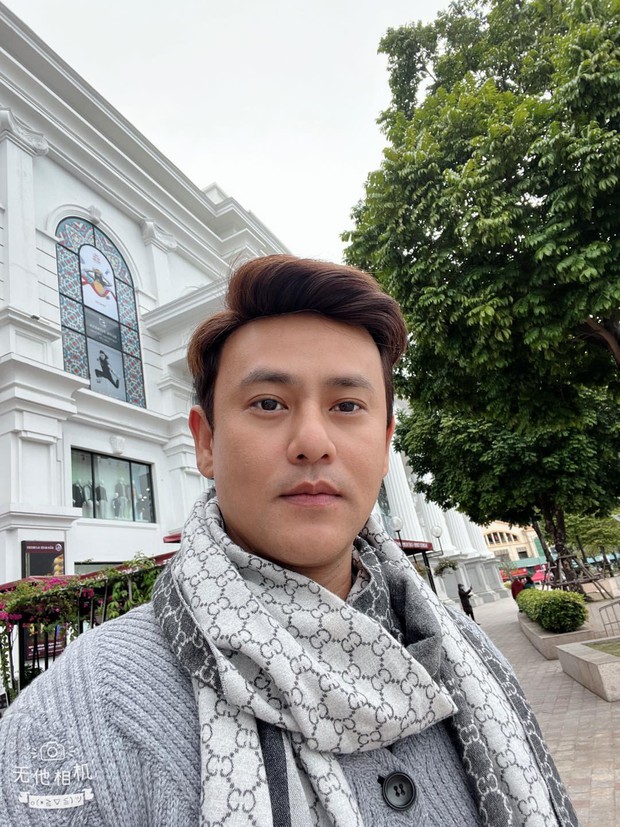 Một sao nam từng bị bóc đội tóc giả ở Sao Nhập Ngũ, phải cấy tóc sau khi lộ hói trên sóng truyền hình - Ảnh 7. Một sao nam từng bị bóc đội tóc giả ở Sao Nhập Ngũ, phải cấy tóc sau khi lộ hói trên sóng truyền hình - Ảnh 7.