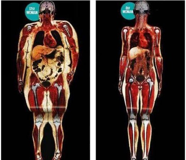 Women with infected organs and a short life expectancy often have 2 circular spots on their bodies: At any age, you should have it checked immediately - Photo 2.