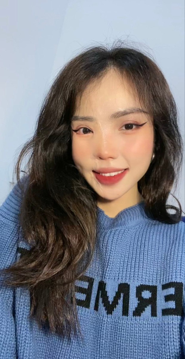 Cô gái bị chồng sắp cưới tạt axit 3 năm trước: Đã đi du học và trải qua 21 ca phẫu thuật - Ảnh 4. Cô gái bị chồng sắp cưới tạt axit 3 năm trước: Đã đi du học và trải qua 21 ca phẫu thuật - Ảnh 4.