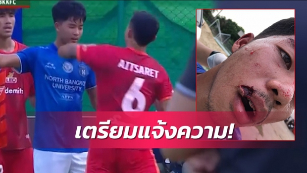 Thai players can be banned for life or jailed for elbowing their opponents with 24 stitches - Photo 1.