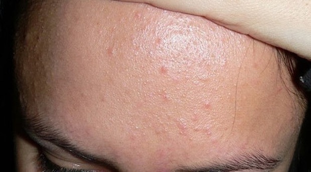 4 changes in the face are warning signs of cervical cancer - Photo 1.