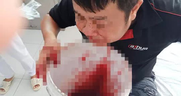 Chảy máu mũi ồ ạt, chàng trai bưng xô hứng, chạy vào bệnh viện cầu cứu - Ảnh 1. Chảy máu mũi ồ ạt, chàng trai bưng xô hứng, chạy vào bệnh viện cầu cứu - Ảnh 1.
