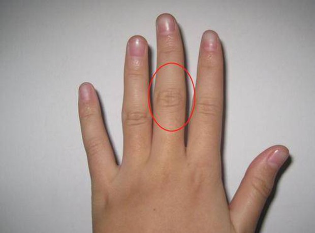 3 characteristics in the middle finger implicitly warn your liver has been damaged, raise your hand and see!  - Photo 3.