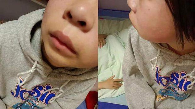 Thầy Phó Hiệu trưởng tát liên tiếp 30 cái, đá nữ sinh lớp 8 đến bầm tím người: Lý do 'trời ơi đất hỡi' gây phẫn nộ