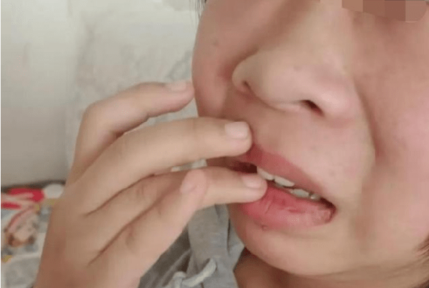 Thầy Phó Hiệu trưởng tát liên tiếp 30 cái, đá nữ sinh lớp 8 đến bầm tím người: Lý do 'trời ơi đất hỡi' gây phẫn nộ