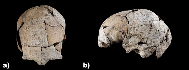 Hộp sọ cổ đại cho thấy bằng chứng về ca phẫu thuật tai đầu tiên của loài người - Ảnh 1.