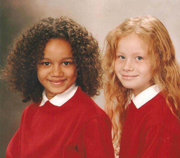 Cặp chị em sinh đôi “khác nhau nhất thế giới” trái ngược từ màu da đến mái tóc từng gây xôn xao khó hiểu giờ trông thế nào sau 25 năm? - Ảnh 2.