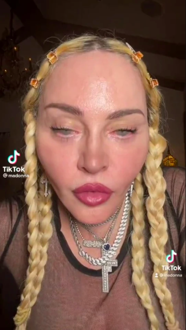 Sexy symbol Madonna makes netizens panic with her terrifyingly deformed face - Photo 3.