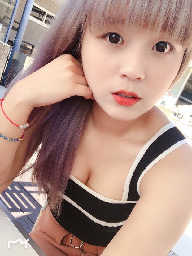 Thể hiện kỹ năng nấu ăn trên sóng, nữ streamer xinh đẹp gặp sự cố nghiêm trọng, bắn nguyên chảo dầu nóng vào người - Ảnh 3. Thể hiện kỹ năng nấu ăn trên sóng, nữ streamer xinh đẹp gặp sự cố nghiêm trọng, bắn nguyên chảo dầu nóng vào người - Ảnh 3.