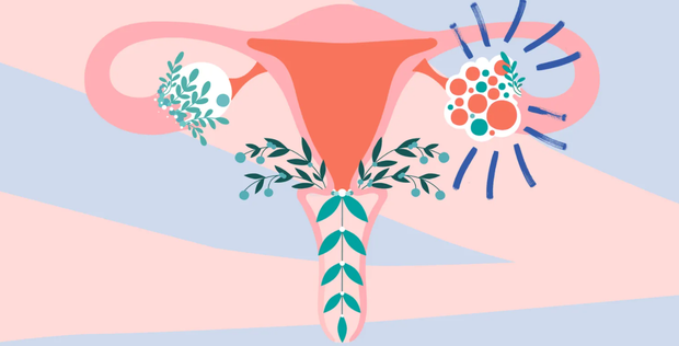 Menstrual disorders, uncontrolled weight gain are all warning signs of polycystic ovaries: Women should absolutely not be ignored, lest they have infertility days - Photo 1.