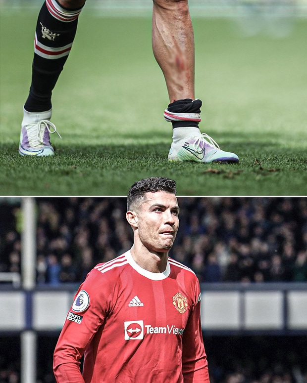Ronaldo rách chân, đổ máu ở trận thua bạc nhược của MU - Ảnh 4.