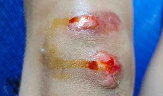 Vượt đèn đỏ gây tai nạn rồi bỏ mặc hai mẹ con bỏ chạy - Ảnh 3. Vượt đèn đỏ gây tai nạn rồi bỏ mặc hai mẹ con bỏ chạy - Ảnh 3.