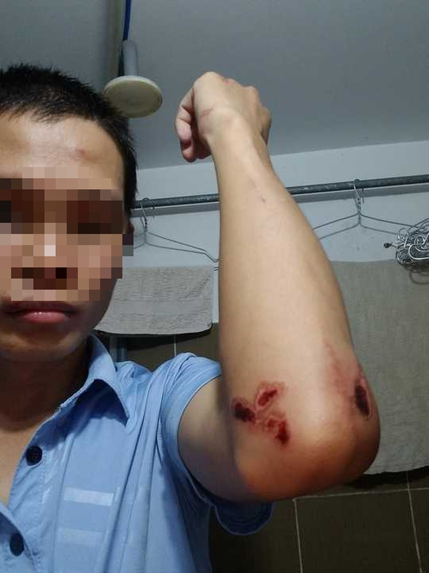CLIP: Technology car driver was brutally attacked in front of Mien Tay Bus Station - Photo 3.