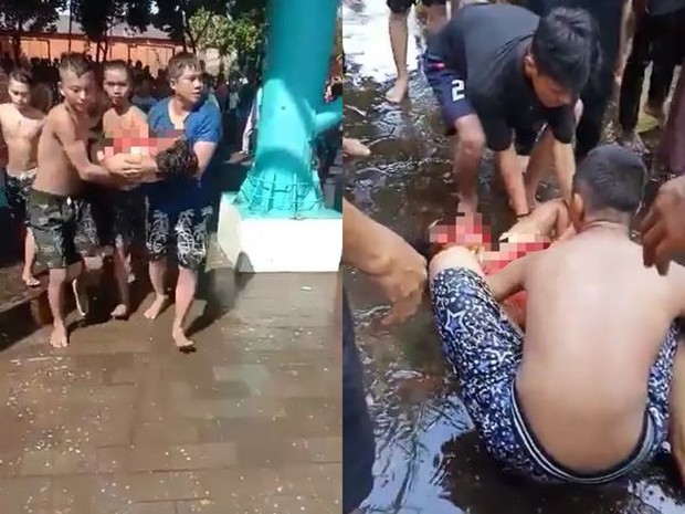 Video: The slide in the water park suddenly collapsed, 16 players fell straight from a height of 10m, heavy casualties - Photo 3.