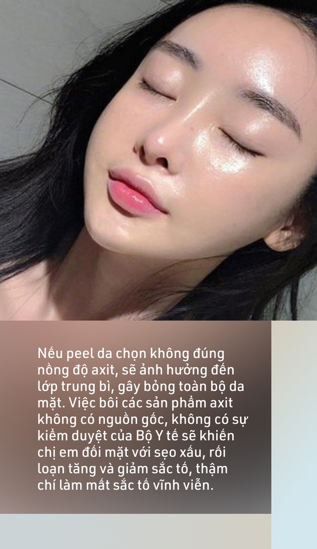 Sai lầm kinh điển khi peel da vào mùa hè gây bắt nắng mạnh, sạm đen, thậm chí bỏng toàn bộ da mặt - Ảnh 3. Sai lầm kinh điển khi peel da vào mùa hè gây bắt nắng mạnh, sạm đen, thậm chí bỏng toàn bộ da mặt - Ảnh 3.