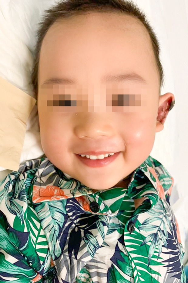 Bé trai sốc phản vệ, suy tuần hoàn sau dùng kháng sinh - Ảnh 4.