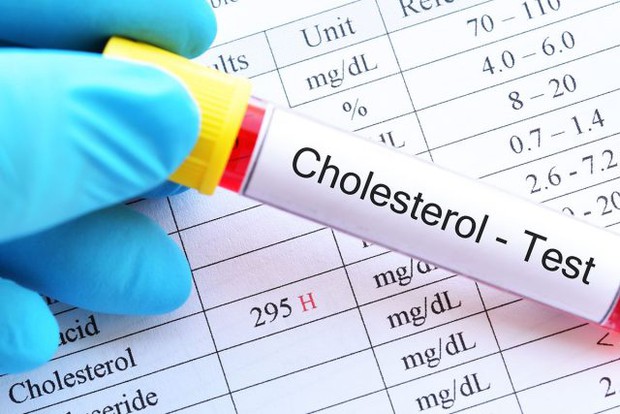 Dấu hiệu cho thấy bạn dễ bị cholesterol cao, nên ăn 3 loại rau hàng ngày để giảm cholesterol - Ảnh 4.