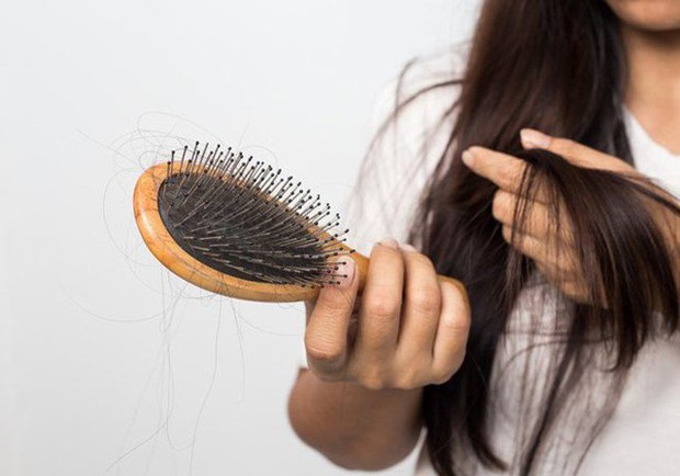 6 nguyên nhân gây rụng tóc và cách khắc phục - Ảnh 1.