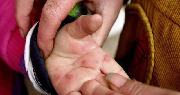 Ấn Độ cảnh báo xuất ɦiện loại virus ɱới gây bệnh cúm cà chuɑ - Ảnh 1.