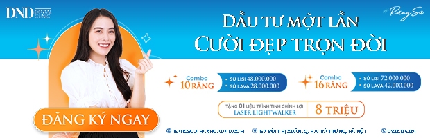 Người trẻ đừng bị cuốn theo trào lưu làm răng sứ giá rẻ, vì 1 chút lợi trước mắt mà rước họa lâu dài! - Ảnh 7.