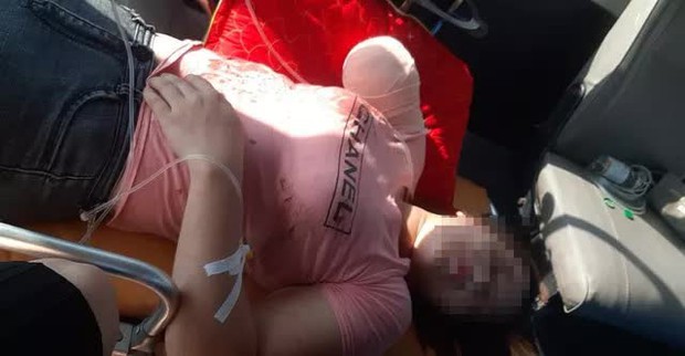 Gia cảnh đáng thương của người phụ nữ bị đứt lìa cánh tay trong vụ lật xe chở 21 công nhân ở Bắc Giang - Ảnh 1.