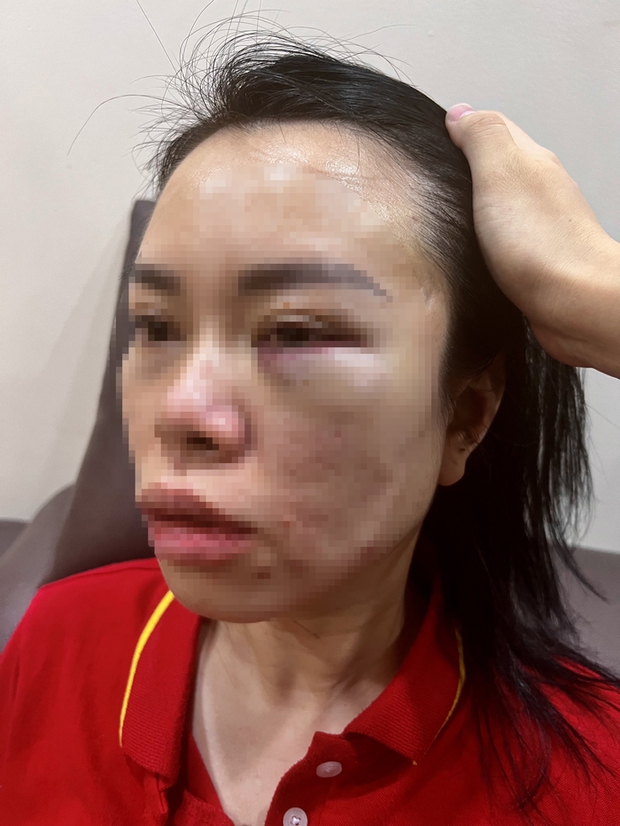 Người phụ nữ tố bị chồng cũ bắt cóc tra tấn dã man: Nhốt trong ô tô, đánh từ Hà Nội lên Hòa Bình - Ảnh 1. Người phụ nữ tố bị chồng cũ bắt cóc tra tấn dã man: Nhốt trong ô tô, đánh từ Hà Nội lên Hòa Bình - Ảnh 1.
