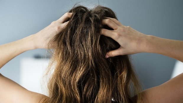 Những cách giải cứu bạn khỏi rụng tóc