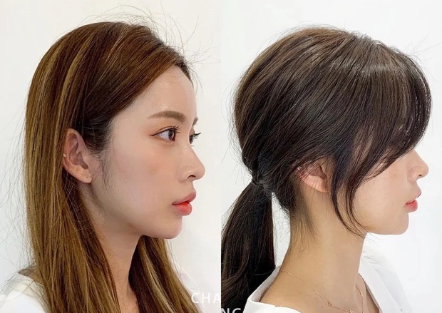 Han So Hee lộ cả mảng đầu hói chỉ vì chọn sai kiểu tóc - Ảnh 8.