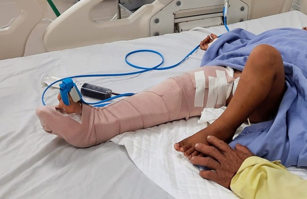 Ô tô chở khách đi chùa gây tai nạn khi xuống dốc, 2 người thương vong - Ảnh 1. Ô tô chở khách đi chùa gây tai nạn khi xuống dốc, 2 người thương vong - Ảnh 1.