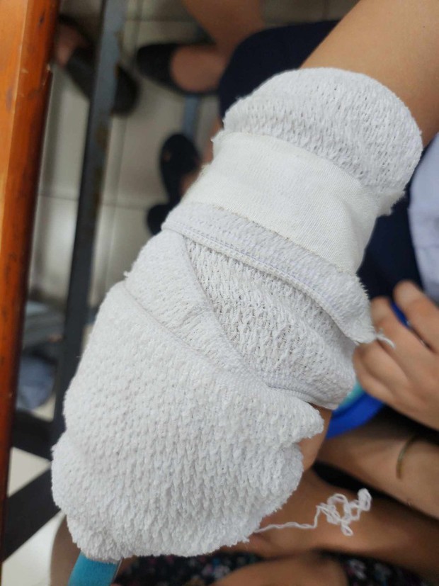 TPHCM: Phụ huynh tố giáo viên đánh gãy xương ngón tay học sinh - Ảnh 1.