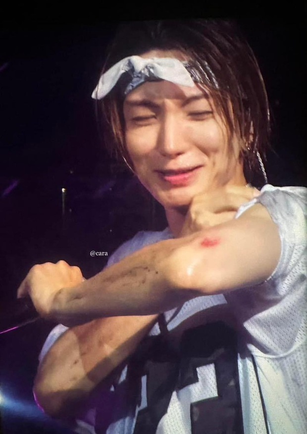 Bí mật đằng sau vụ việc Lee Teuk (Super Junior) vấp ngã trên sân khấu TPHCM: Fan phải ngỡ ngàng khi biết sự thật!