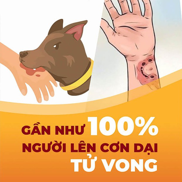 Bé gái 7 tuổi bị tấn công bởi 4 con chó, BV Nhi cảnh báo nguy cơ bệnh dại