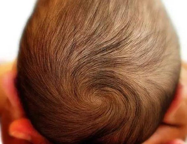 Đứa trẻ có mấy xoáy tóc thì thông minh hơn? Câu trả lời của các nhà khoa học sẽ khiến bạn bất ngờ - Ảnh 1.