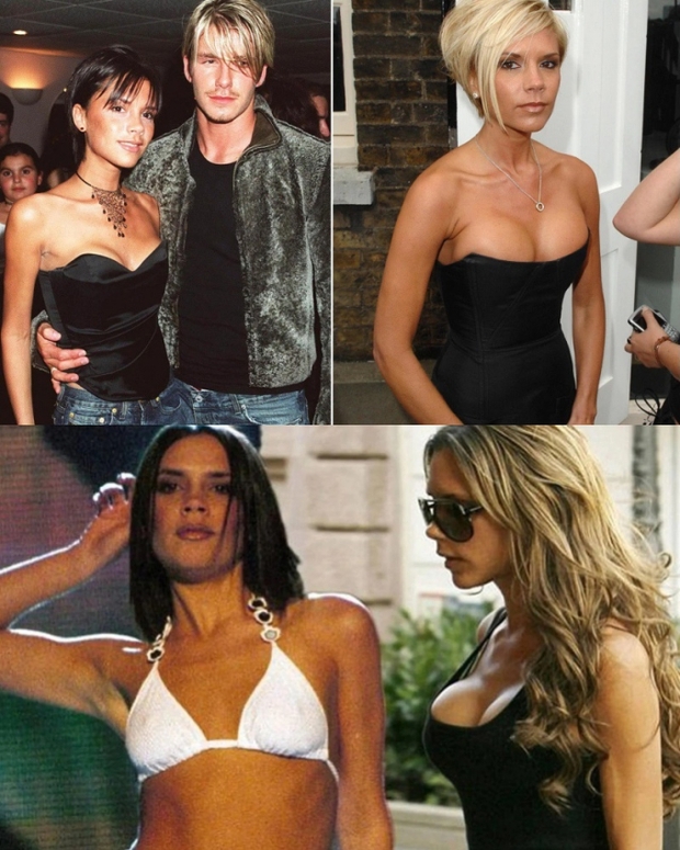 Victoria Beckham hối hận vì lạm dụng dao kéo để trùng tu vòng 1: Thậm chí tôi còn chẳng thể nói thật với con gái - Ảnh 3.