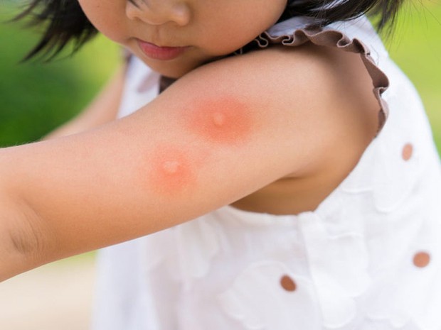 Đau lòng trước cái chết thương tâm của bé gái do mắc sốt xuất huyết, câu chuyện hết sức đáng tiếc theo lời người mẹ chia sẻ