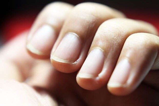 Bác sĩ tiết lộ 5 bộ phận cơ thể nhiều người trong chúng ta chưa rửa đủ sạch - Ảnh 3. Bác sĩ tiết lộ 5 bộ phận cơ thể nhiều người trong chúng ta chưa rửa đủ sạch - Ảnh 3.