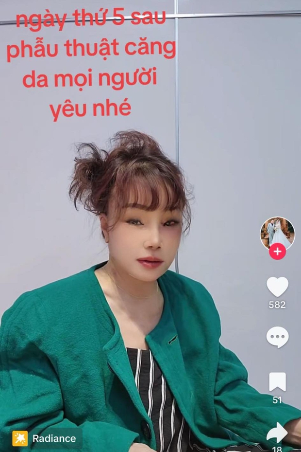 Cô dâu 62 tuổi Thu Sao lộ ngoại hình khác lạ sau khi phẫu thuật căng da mặt níu giữ tuổi xuân, tiết lộ thái độ của chồng trẻ - Ảnh 3.