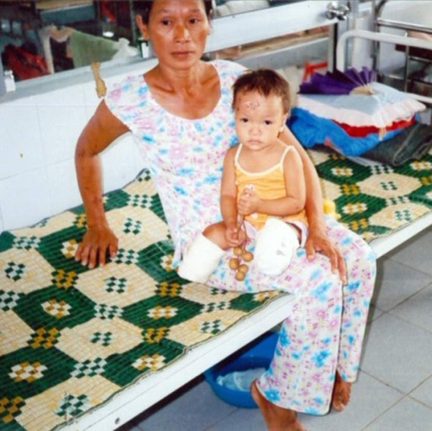 Cuộc sống hiện tại của bé gái gốc Việt bị bố mẹ nổ bom mất 2 chân: Được báo chí thế giới gọi là nữ kình ngư thần kỳ, trở thành đại sứ truyền cảm hứng cho những người khuyết tật - Ảnh 5.