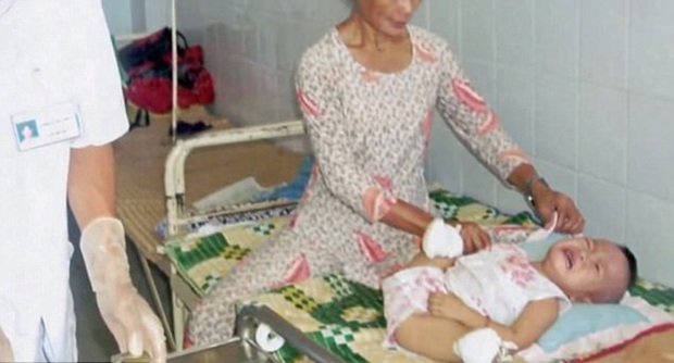 Cuộc sống hiện tại của bé gái gốc Việt bị bố mẹ nổ bom mất 2 chân: Được báo chí thế giới gọi là nữ kình ngư thần kỳ, trở thành đại sứ truyền cảm hứng cho những người khuyết tật - Ảnh 2.