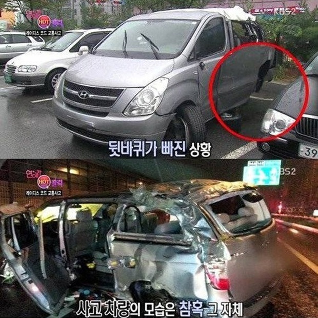 Nữ idol Kpop gặp di chứng khủng khiếp sau vụ tai nạn thảm khốc của Ladies Code: Mặt tôi bị hủy hoại - Ảnh 6.