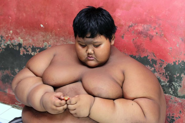 Từng nặng gần 200kg khi mới 10 tuổi, cậu bé “béo nhất thế giới” bây giờ ra sao sau hành trình giảm cân không tưởng? - Ảnh 2.