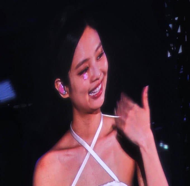 Close-up of the wound near Jennie's sensitive position (BLACKPINK): Will beauty be affected?  - Photo 3.